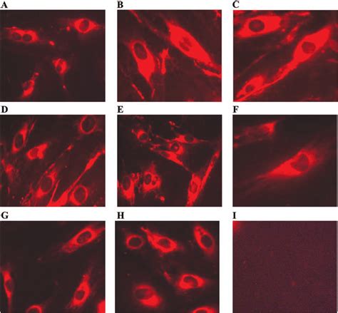 Representative Immunofluorescence Photomicrograph Of Endothelial Cells