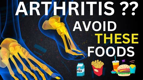 6 Worst Foods To Avoid If You Have Arthritis Youtube