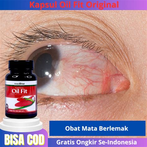 Jual Obat Mata Berlemak Mata Minus Untuk Di Minum Mata Katarak