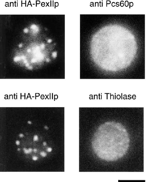 Figure 6 from Pex17p of Saccharomyces cerevisiae Is a Novel Peroxin and ... 