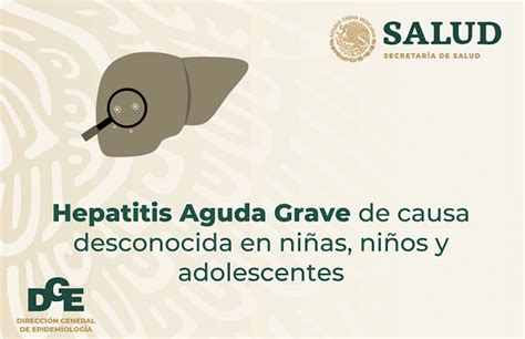 Hepatitis Aguda Grave De Causa Desconocida En Ni As Ni Os Y