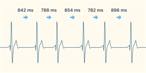 Heart Rate Variability Hrv Meditation Training Fitmind