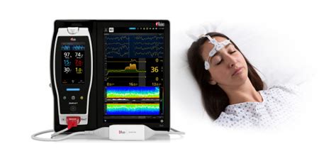 마시모 연구 통해 심장마비 겪은 Icu 환자의 신경병적 증후와 장기 생존 가능성 예측하는 마시모 Sedline®의 기능 평가