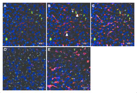 Uptake Of Fitc Lps By Liver Cells A Sinusoidal Endothelial Cell Download Scientific Diagram