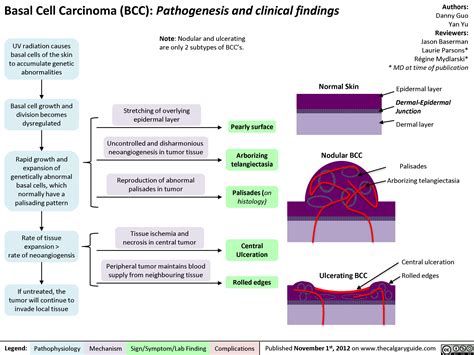 Basal Cell Carcinoma (BCC) | Calgary Guide