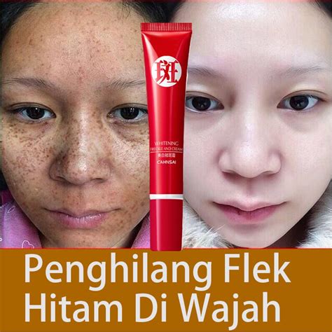 Jual Penghilang Flek Hitam Di Wajah Night Whitening Salep Flek Hitam