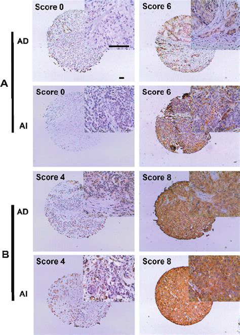 Immunohistochemical Staining Of Prostate Tissue Microarrays