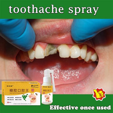 Toothache Oral Spray Toothache Reliever Toothache Pain Relief Teeth Care Sprays 35ml Prevent