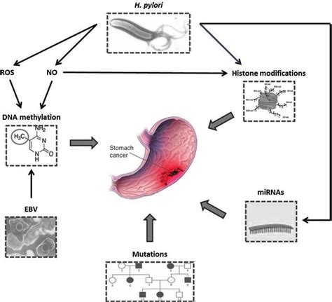 Epigenetic And Genetic Alterations Leading To Gastric Cancer Stomach