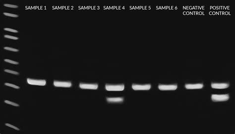 Ez Pcr Mycoplasma Kit For The Detection Of Mycoplasma In Cell Culture