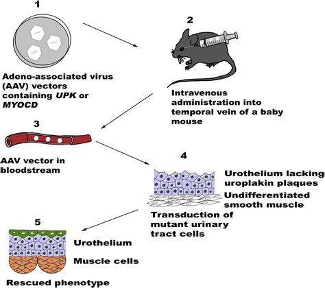 Envisioning Treating Genetically Defined Urinary Tract Malformations