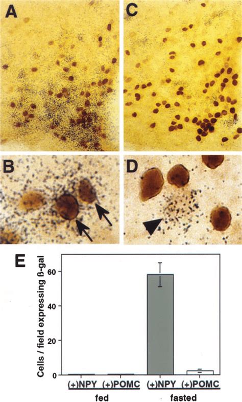 Fasting Activates Arc Npy Neurons Photomicrographs Of Coronal Arc