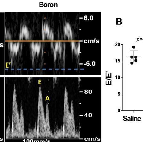 Tissue Doppler Echocardiography A Representative Raw Tracings Of