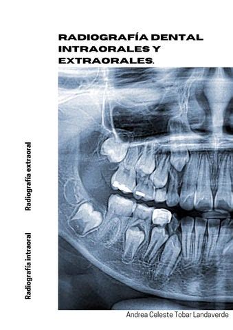 Radiografías by celeste tobar Issuu