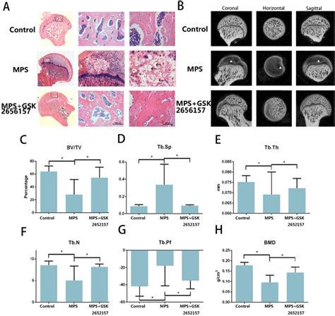 Perk Inhibitor Gsk2656157 Protected The Femoral Head From Osteonecrosis