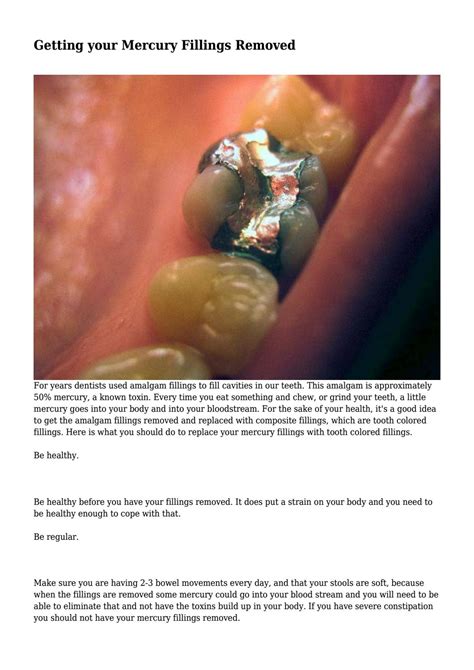 Getting Your Mercury Fillings Removed By Jameserickson Issuu