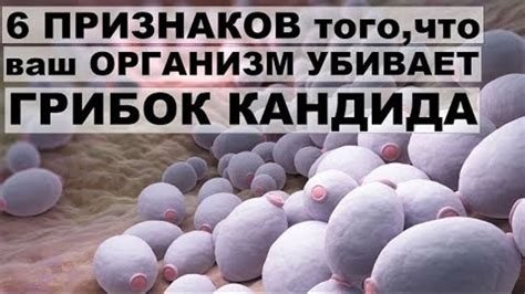 6 ПРИЗНАКОВ того что ваш ОРГАНИЗМ УБИВАЕТ ГРИБОК КАНДИДА КАК избавиться от него натуральным спосо