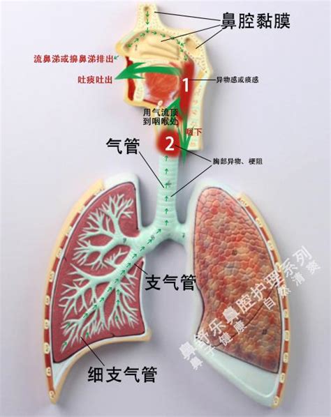 嗓子里有痰就是吐不出来，求咳痰妙招？ 知乎