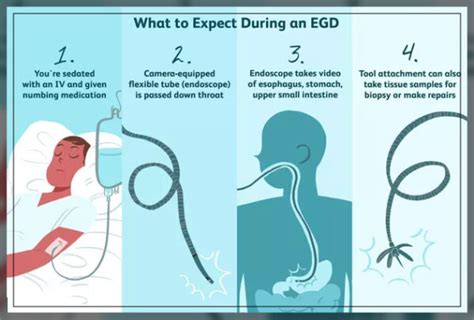 Endoscopy Procedure Uses And Types Engiomed