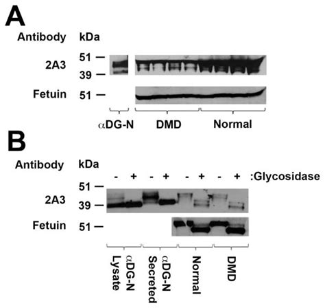 N terminal α Dystroglycan αDG N A Potential Serum Biomarker for