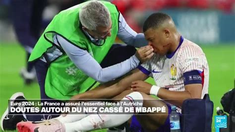 Euro 2024 inquiétude après la fracture du nez de Mbappé FRANCE 24