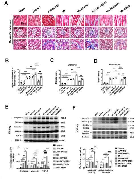 Excessive Fibroblast Growth Factor Promotes Renal Fibrosis In Mice