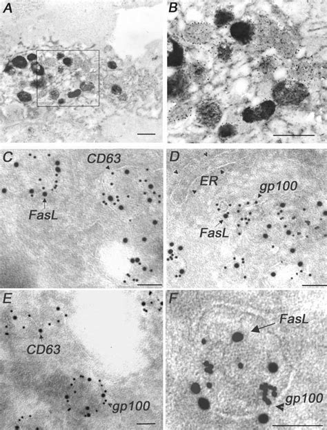 Immunoelectron Microscopic Analysis Of FasL Expression In Human