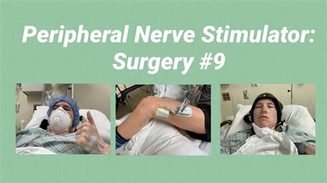 Peripheral Nerve Stimulator Surgery Day YouTube