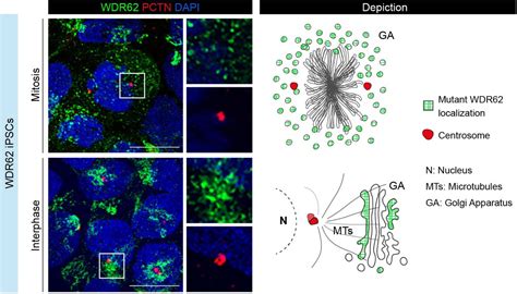 Microcephaly Associated Wdr62 Mutations Hamper Golgi Apparatus To