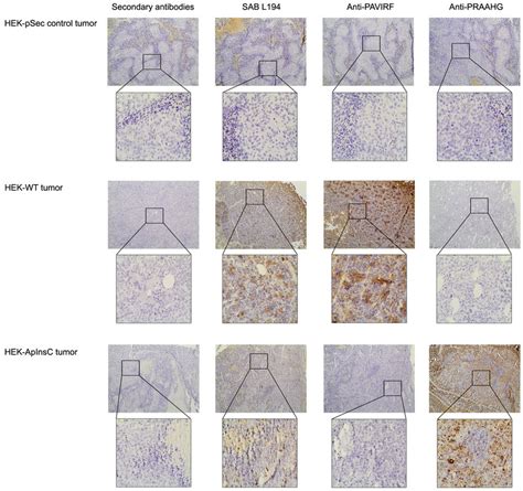 Immunohistochemistry On Tumors Xenotransplanted In Nude Mice HEK PSec