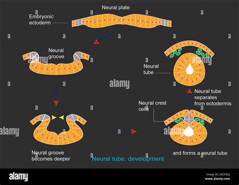 Neural tube development. Artwork showing the stages of neural tube ...