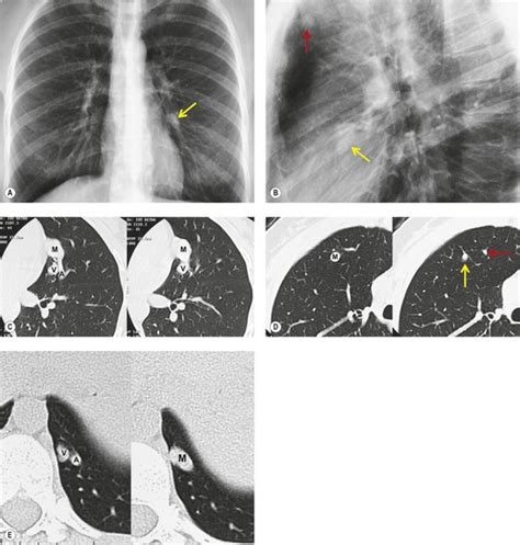 16 Congenital Anomalies Radiology Key