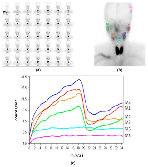 Diagnostics Free Full Text Recent Advances In Salivary