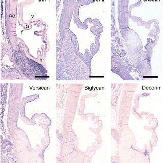 Valvular Interstitial Cell Vic Markers Tile Scans Of Sheep Aortic