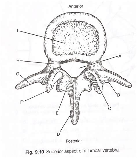 Superior Aspect Of A Lumbar Vertebra Diagram Diagram Quizlet