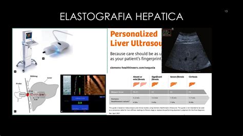 IMAGENOLOGIA DE HIGADO Y VIAS BILIARES RX PPT