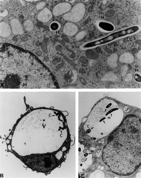 A Electron Micrograph Of Murine BMM Infected With M Avium M Note