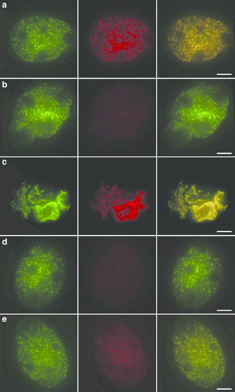 Analyses Of Mitochondrial Membrane Potential In Maternal Mitochondria Download Scientific