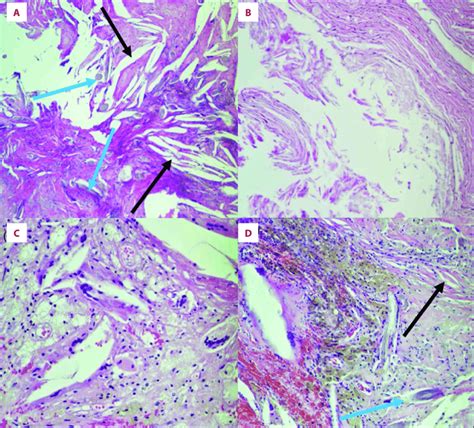 Hematoxylin And Eosin Stains With A 40× B D 100× And C 200×