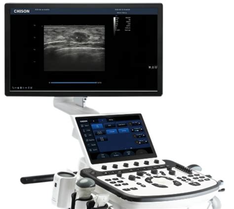 Can You Detect Breast Cancer With An Ultrasound Wuxi Jiangsu China