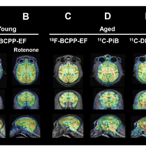 Typical Pet Mri Fusion Images Of F Bcpp Ef Pet A C C Pib D