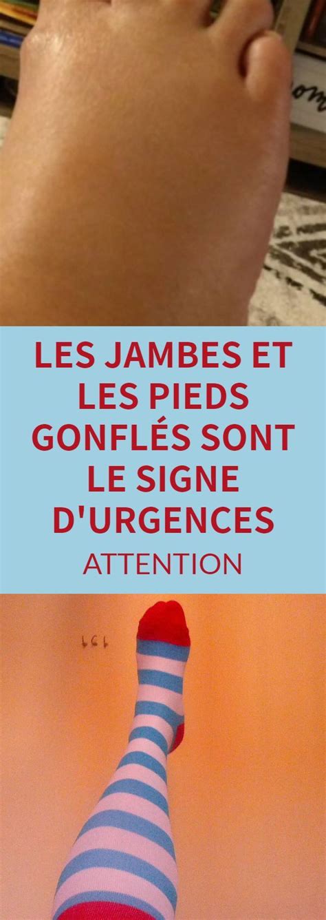 Des jambes et des pieds gonflés peuvent dans le pire des cas indiquer