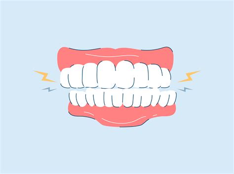 Bruxism Teeth Grinding Symptoms Causes And Treatments Snow® Oral Care