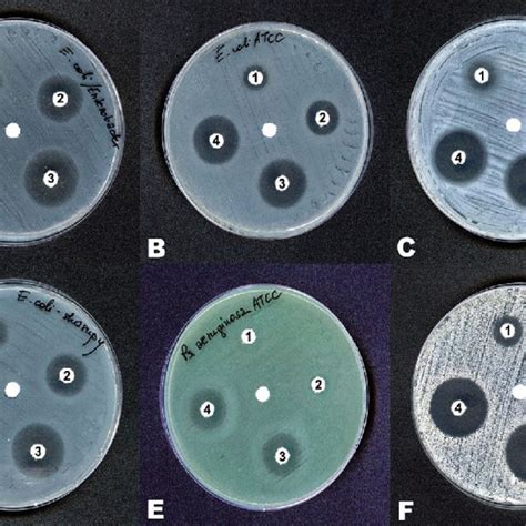 Inhibition Zones Of Six Strains Of A Escherichia Coli B