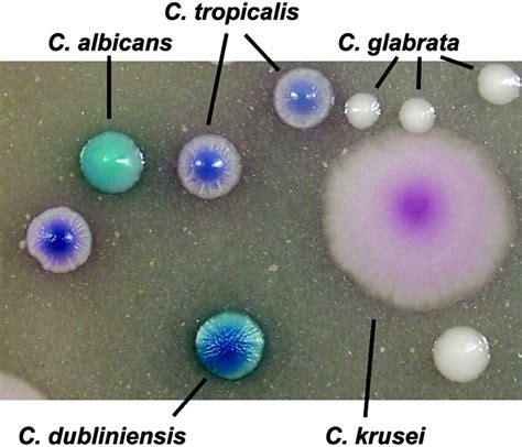 Candida Colony