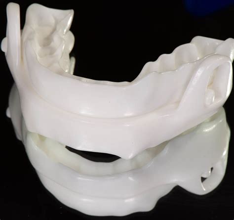 Dispositivo de Avance Mandibular Clínica Dental Blay Monzo