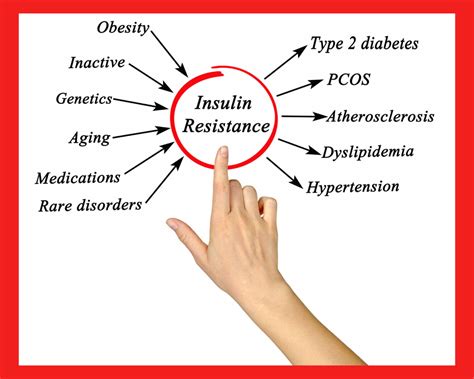 How To Lose Weight With Insulin Resistance Health Fitness Weight Loss