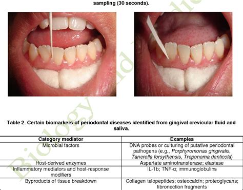 Oral Biomarkers In The Diagnosis And Progression Of Periodontal Diseases Semantic Scholar