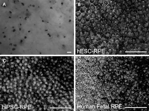 Morphology Of Fetal Rpe Hesc Rpe And Hipsc Rpe A Pigmented Cells