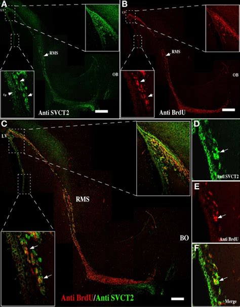 Mitotically Active Cells Express Svct2 Immunofluorescence And Confocal Download Scientific